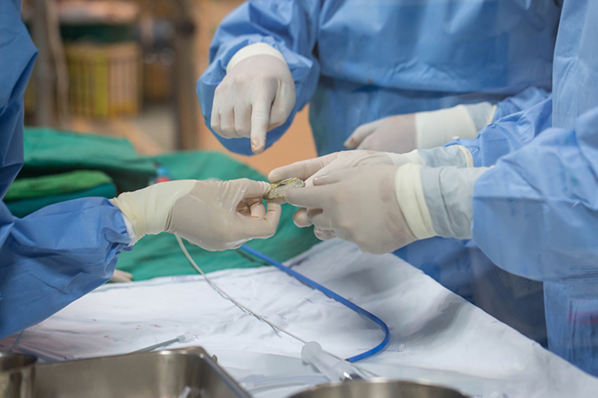 CT Coronary Angiogram (CTCA)
