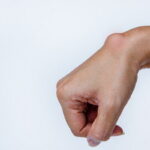 Ganglion Ganglion