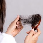 HAIR LOSS (aka ALOPECIA) HAIR LOSS (aka ALOPECIA)